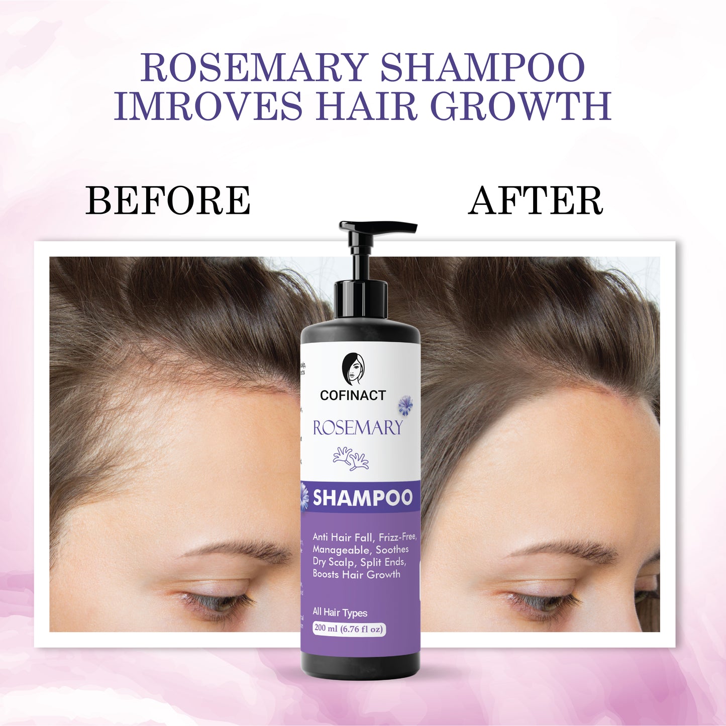 Rosemary Shampoo – Strengthening, Moisturizing, and Nourishing Formula for Healthy Hair