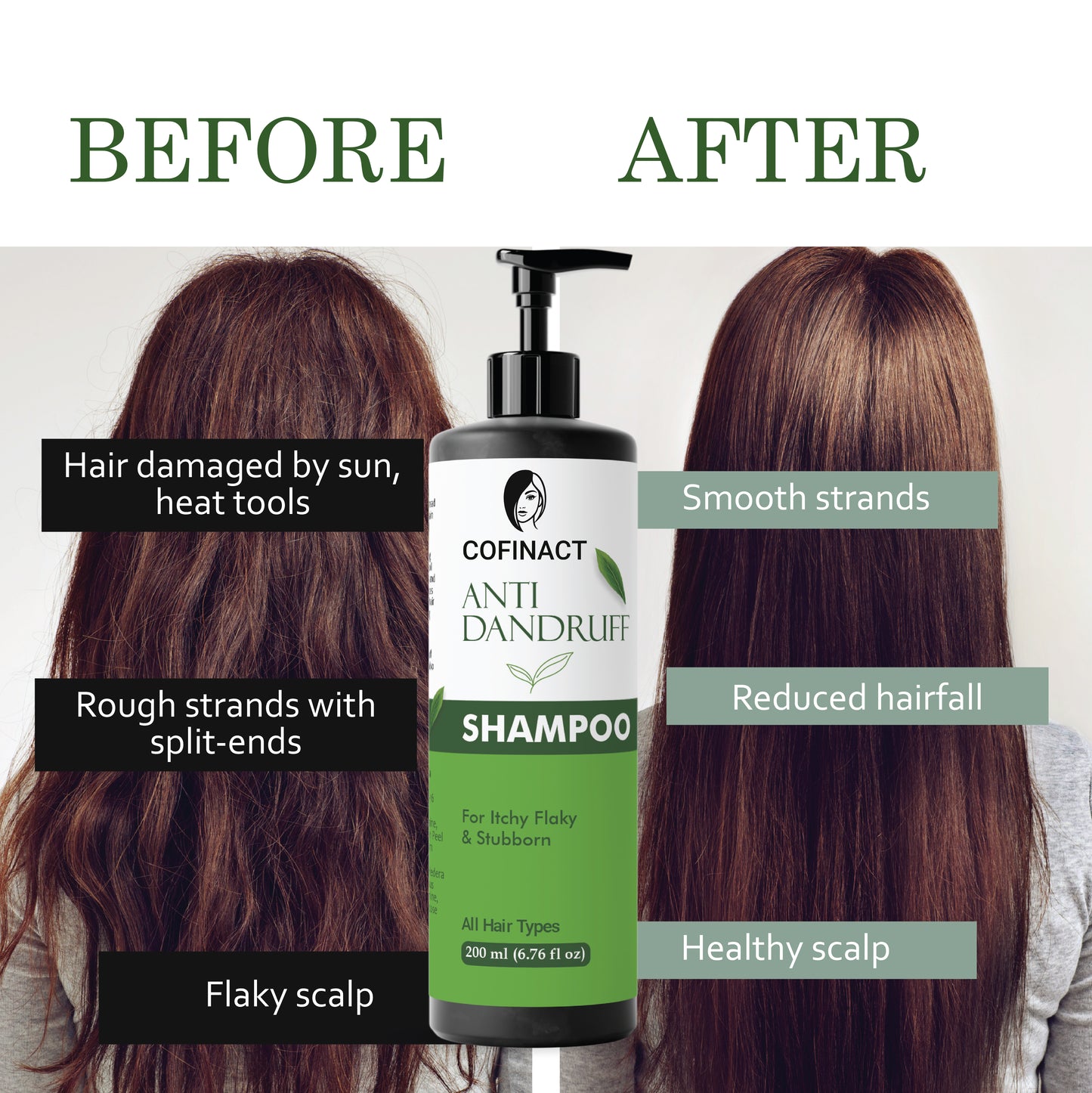 Anti-Dandruff Shampoo – Soothe & Protect, Removes Flakes, Reduces Scalp Irritation, Moisturizes Hair