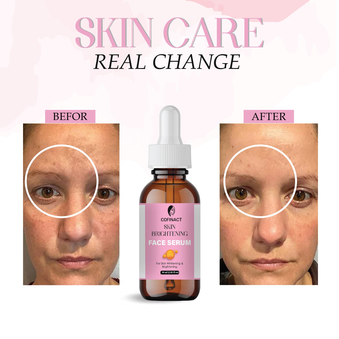 Skin Brightening Serum for Glowing & Even Skin Tone | Dark Spot Removal | Hydrating & Lightweight Face Serum for Radiant Skin