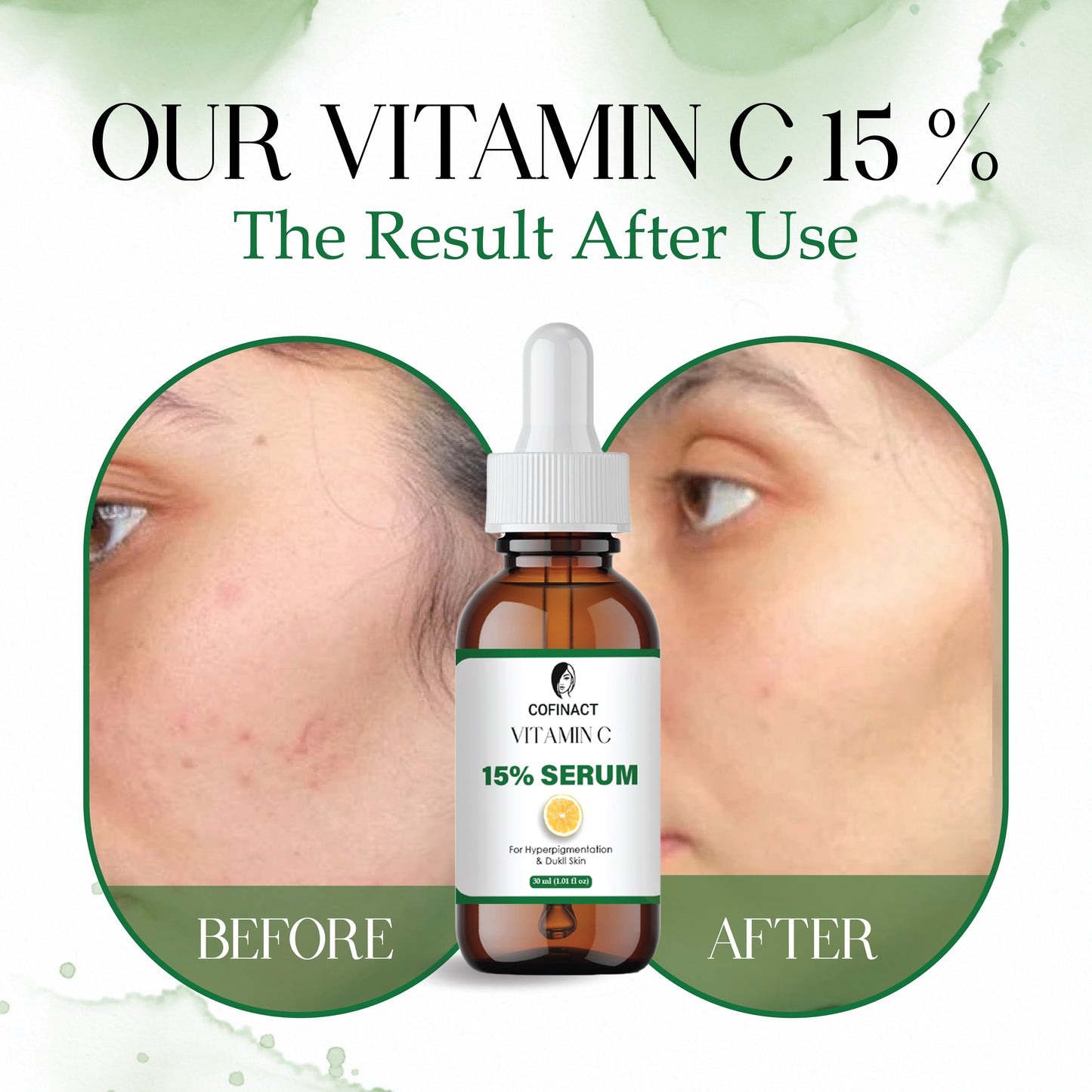 Vitamin C Face Serum with Hyaluronic Acid & Vitamin E | Brightening & Anti-Aging Serum for Glowing Skin | Reduces Dark Spots, Fine Lines & Pigmentation | Lightweight & Non-Greasy Formula